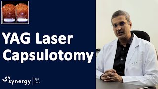 YAG Laser Capsulotomy after Cataract Surgery [upl. by Ydnik]