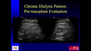 Contrast Enhanced Ultrasound of the Kidneys [upl. by Prentice]