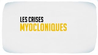 Les crises myocloniques [upl. by Crespo]