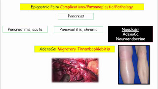 12DaysinMarch Epigastric Pain and Pancreatic Disorders for USMLE Step One [upl. by Arella]