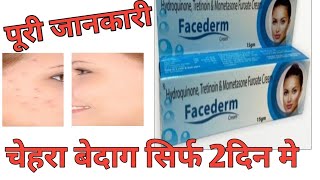 Hydroquinone Tretinoin amp Mometasone Furoate Cream Review by Guru Kirpa Clinic [upl. by Ok]