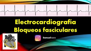 🏅 ELECTROCARDIOGRAMA 9 🫀 BLOQUEOS FASCICULARES [upl. by Ydnil105]