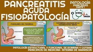 PANCREATITIS AGUDA FISIOPATOLOGÍA  GuiaMed [upl. by Jessika]