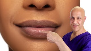 How to Plump Your Lips Naturally Dr Mandell [upl. by Kassi]