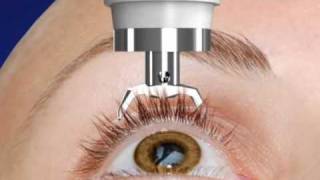 Unique DIATON Tonometry Through Eyelid  with Diaton Tonometer  Introduction  Description Part1 [upl. by Laurianne]