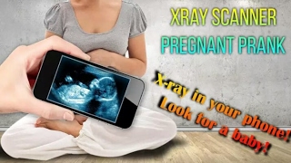 Xray Scanner Pregnant Prank [upl. by Rutherfurd]