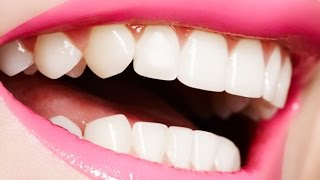 How to Whiten Teeth At Home In 5 Minutes Naturally amp Instantly [upl. by Adnoral427]