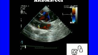 Echocardiography [upl. by Palmira37]