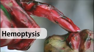 Hemoptysis causes diagnosis and management [upl. by Richma]