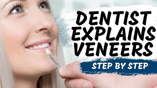 Porcelain Veneers Procedure Explained [upl. by Barrada]