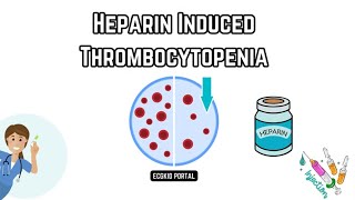 🩺 Understanding HeparinInduced Thrombocytopenia HIT Causes pathophysiology and Treatment 🩺 [upl. by Malinin]