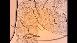 Development of Leishmania mexicana in Lutzomyia longipalpis in the absence of sugar feeding [upl. by Niliram]