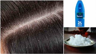 Coconut oil amp camphor for dandruff hairRemove dandruff with 2 ingredientsVery genuine hair tip [upl. by Analram910]