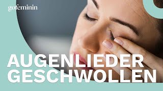 Das sind mögliche Gründe für geschwollene Augenlider [upl. by Notlil]