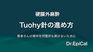 硬膜外麻酔 Tuohy針の進め方（患者さんの背中を何箇所も刺さないために）DrEpiCal [upl. by Fransis]