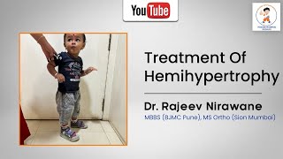 Treatment Of Hemihypertrophy Successfully done by Dr Rajeev Nirawane [upl. by Haliek]