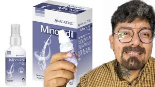 MINOXIDIL ANACASTEL PARA LA BARBA 🧔🏽‍♂️ [upl. by Sezen13]