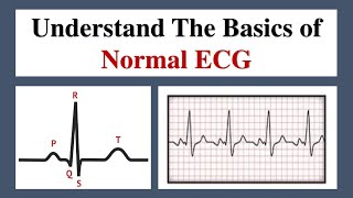 Electrocardiography Basics  ECG  in Hindi [upl. by Sivraj]