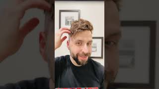 From thinning to winning Your journey starts here with Lordhair hairstyle hairloss [upl. by Ibbison]