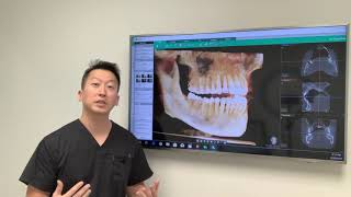 IV Sedation vs Oral Sedation [upl. by Grieve]