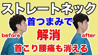 【ストレートネックの治し方】4つのストレッチで首こりスマホ首解消！腰痛も同時に改善できる [upl. by Patten933]