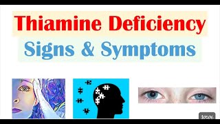 Vitamin B12 Deficiency Is adult and childs vitamineB12deficiency [upl. by Isbella570]