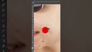 How to remove skin blemishes easily using Photoshop [upl. by Briny]