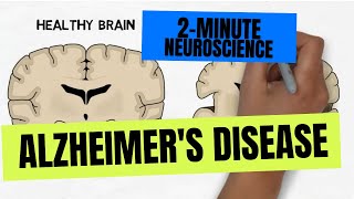 2Minute Neuroscience Alzheimers Disease [upl. by Melliw]