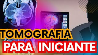 VEJA ESSA AULA DE TOMOGRAFIA PARA INICIANTES RADIOLOGIA [upl. by Geordie]