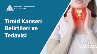 Tiroid Kanseri Belirtileri ve Tedavisi  Prof Dr Erhan Ayşan [upl. by Albin]