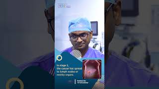 Liver Metastasis in Stage 4 Cancer Key Differences and What They Mean  Dr Praveen Kammar [upl. by Micah634]