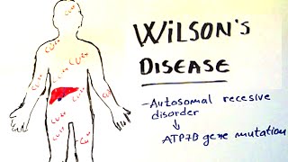 Wilsons Disease  lecture etiology clinical presentation diagnosis and treatment [upl. by Thatch155]