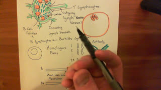 Burkitts Lymphoma Part 2 [upl. by Puff596]