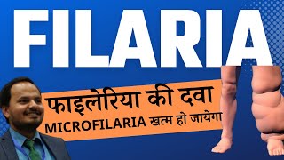 Filaria ki dawa Treatment of microfilaria Filariasis ka ilaaz Dr Pratyush Kumar [upl. by Lidaa]