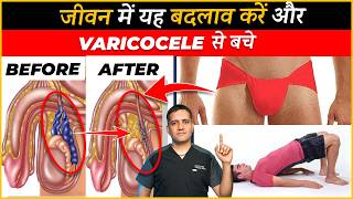 10 Lifestyle changes to stop growing varicocele  Dr Gaurav Gangwani Interventional Radiologist [upl. by Calley327]