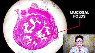 Histology of Uterine Tube Fallopian Tubes  Dr Sibani Mazumder [upl. by Guillermo]