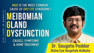 Meibomian Gland Dysfunction Causes Symptoms and remedy for dry eyes MGD by Dr Saugata Poddar [upl. by Notsuj]