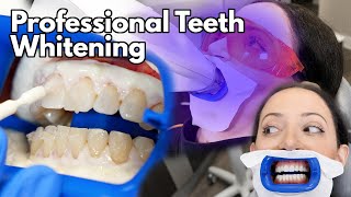 Teeth Whitening At The Dentist  Fastest Way To Whiten Your Teeth [upl. by Atilem]