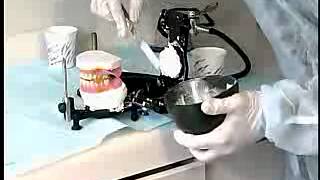 Complete Denture Procedure  21 CLINICAL REMOUNT AND OCCLUSAL REFINEMENTS [upl. by Ahsinnod210]