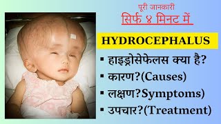 Hydrocephalus Symptoms Causes Treatment In Hindiहाइड्रोसिफ़लस लक्षण कारण और उपचार [upl. by Siddon]