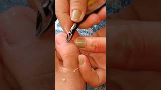 Vlog110 CSV toenail cleaning session pedicure cuticlecleaning cuticlecleaning DeadskinRemoval [upl. by Inoj128]