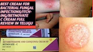 BEST CREAM FOR BACTERIA FUNGAL INFECTION ON SKINBETNOVATE C FULL REVIEW IN TELUGU [upl. by Signe797]