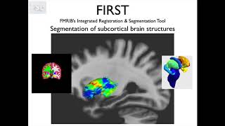 8 Segmentation Subcortical Brain Structures and FIRST Struc E2 [upl. by Ollehto673]