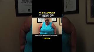 30 Yaşındaki Kadın Tam 337 Kilo  2 Bölüm filmözetleri diziler [upl. by Schaeffer]