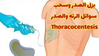 طريقة بزل الجنب وسحب سائل الرئة thoracocentesis [upl. by Weixel]