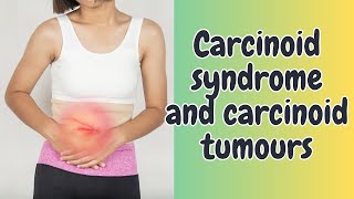 Carcinoid syndrome and carcinoid tumours [upl. by Harac681]