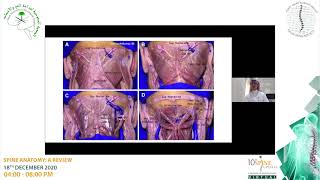 10th Spine Update Craniovertebral Junction Anatomy  Dr Abdulhadi Algahtani [upl. by Hisbe647]