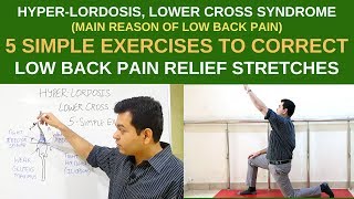 Hyperlordosis 5 Simple Exercises For lower back pain relief LOWER CROSS SYNDROME Pelvic Tilt [upl. by Summer32]