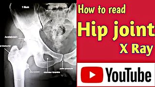 How to read Hip joint X Ray । Hip joint Anatomy । Uday Xray [upl. by Fanchet774]