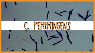 Clostridium Perfringens [upl. by Wilde]